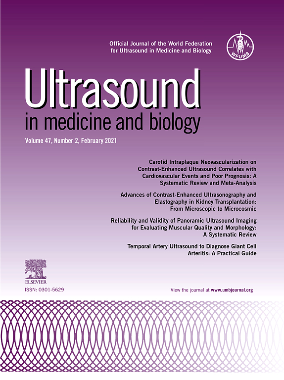 Collagen and Chondrocyte Concentrations Control Ultrasound Scattering in Agarose Scaffolds