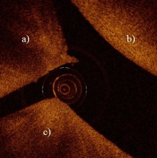 Application of optical coherence tomography enhances reproducibility of arthroscopic evaluation of equine joints